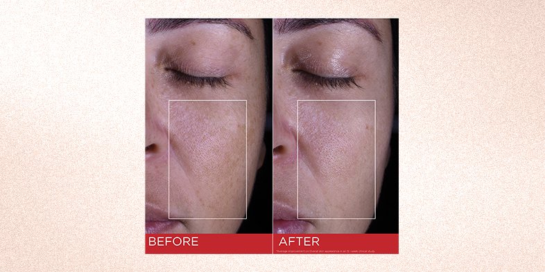 In Article Sunscreen Or Moisturizer First RevitaLift Triple Power Moisturizer SPF 30